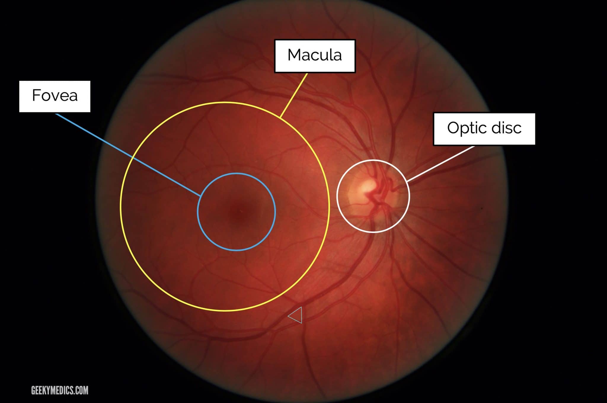 What Is a Detached Retina? - Outlook Eyecare